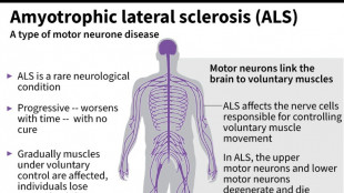 US company withdraws ALS drug after it fails in trial